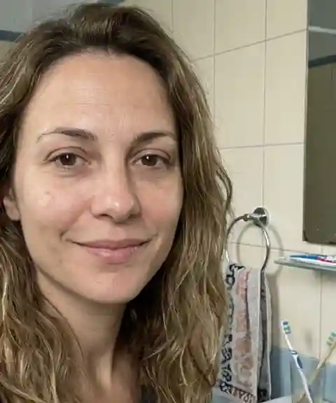 Before — Jawline definition