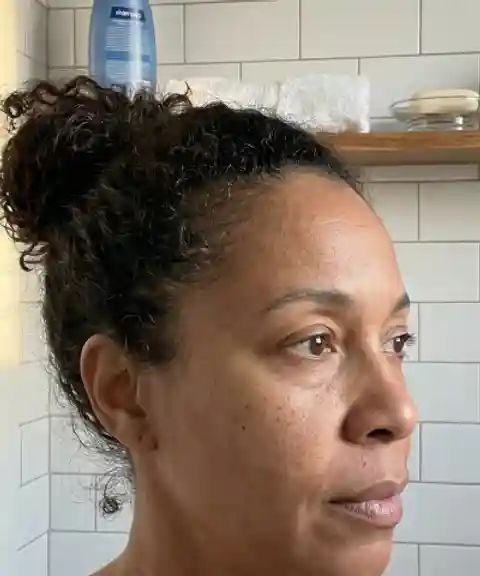 Before — Skin radiance