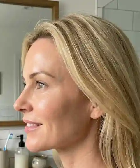 After — Neck and jaw toning