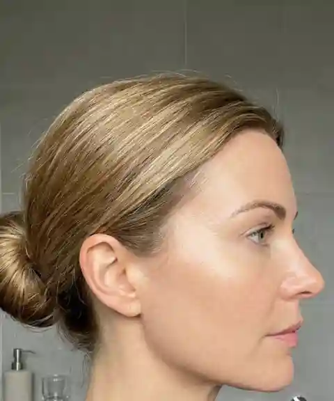 After — Skin firmness