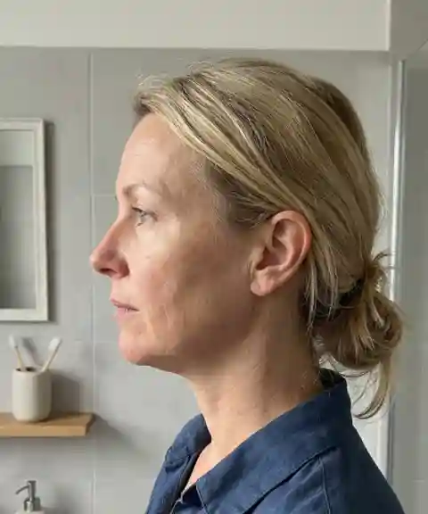 Before — Overall glow