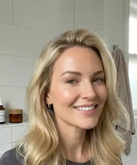 After — Forehead smoothing