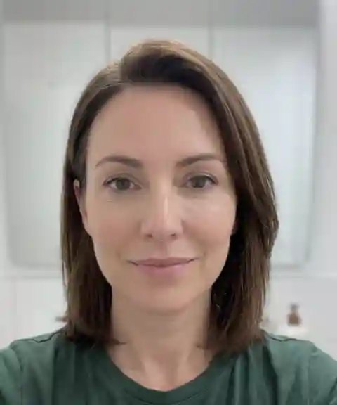 After — Under-eye improvement